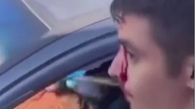 Malatya'da MOTAŞ sürücüsü şoför değil kabadayı çıktı!