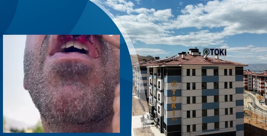  TOKİ'de Evini Teslim Almaya Gitti, Hastanelik Oldu İddiası!